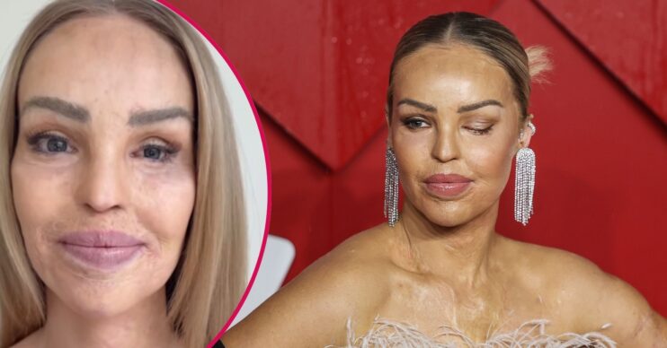 Katie Piper with glass eye / Katie Piper on the red carpet