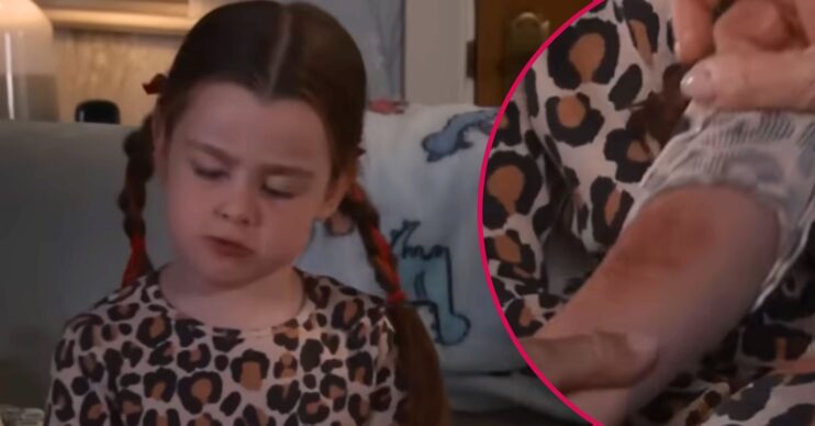 ED comp: Corrie Shanice / bruises on her arm