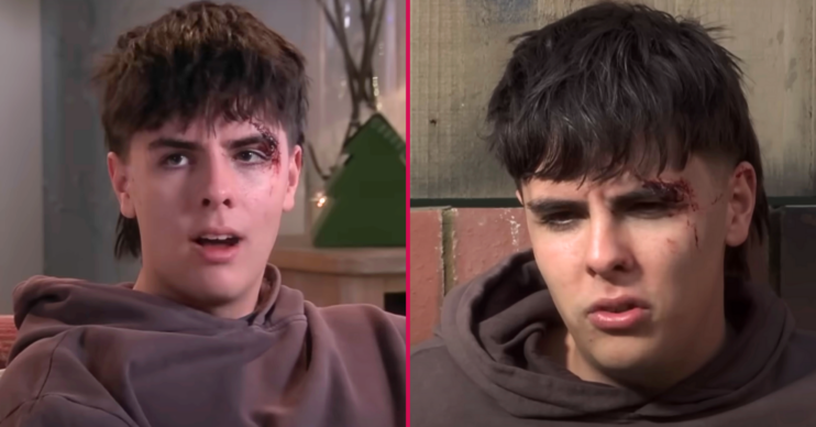 ED Split image: Mason Coronation street